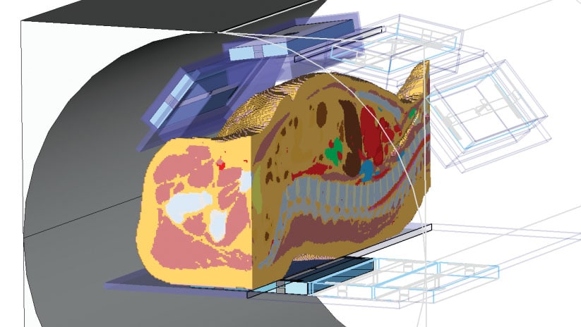 cst-human-body-mri.jpg